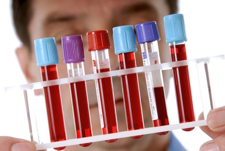 Tes darah untuk diagnosis kecacingan